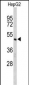 CFLAR Antibody (Center)